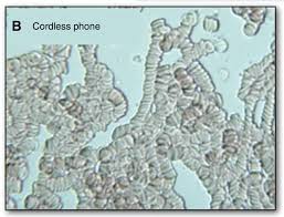Cell reactions to electromagnetic fields from cordless phone use Image