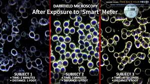 Cell exposure to smart meter Image